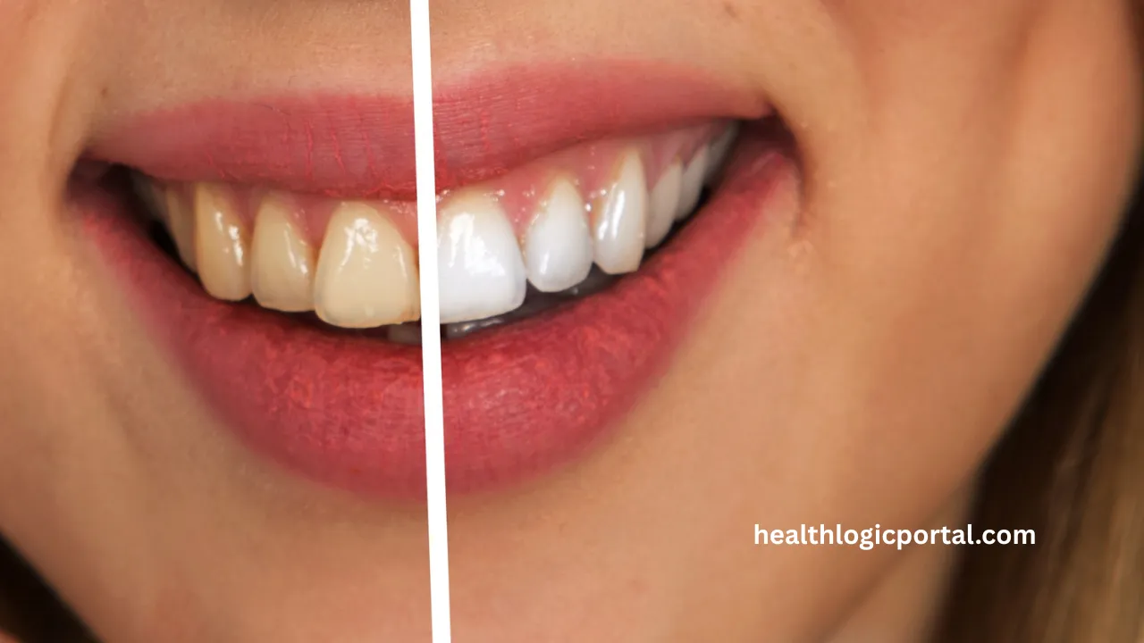 Before and after teeth cleaning showing plaque removal with proper daily oral hygiene