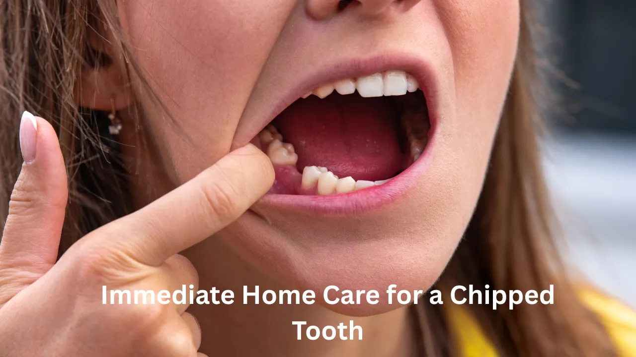 Home Care for a Chipped Tooth